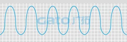 干货|太全了,振动光纤7大场景的安装方式图文详解!(图21)